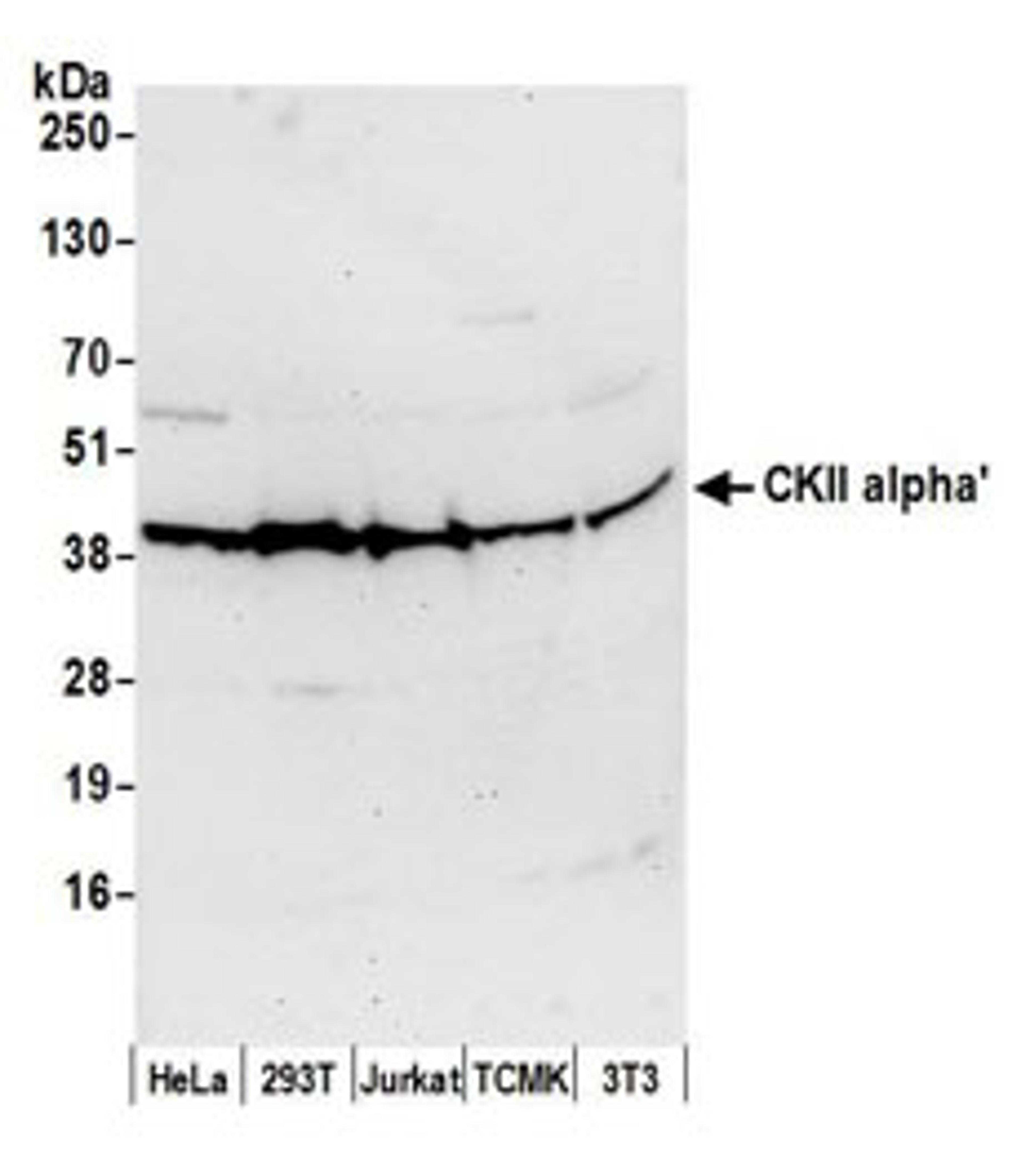 Detection of human and mouse CKII alpha' by western blot.