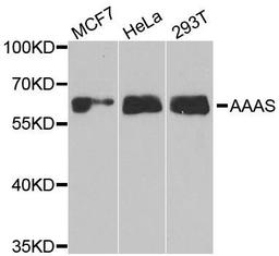 Western blot analysis of extracts of various cell lines using AAAS antibody