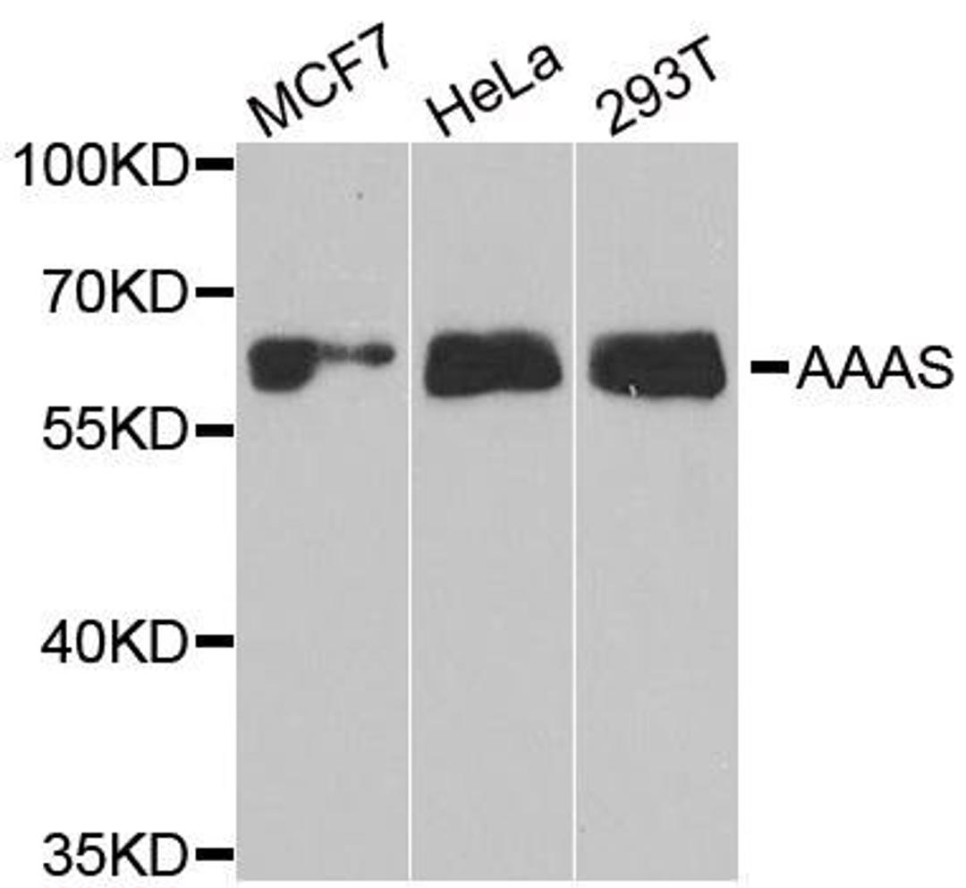 Western blot analysis of extracts of various cell lines using AAAS antibody