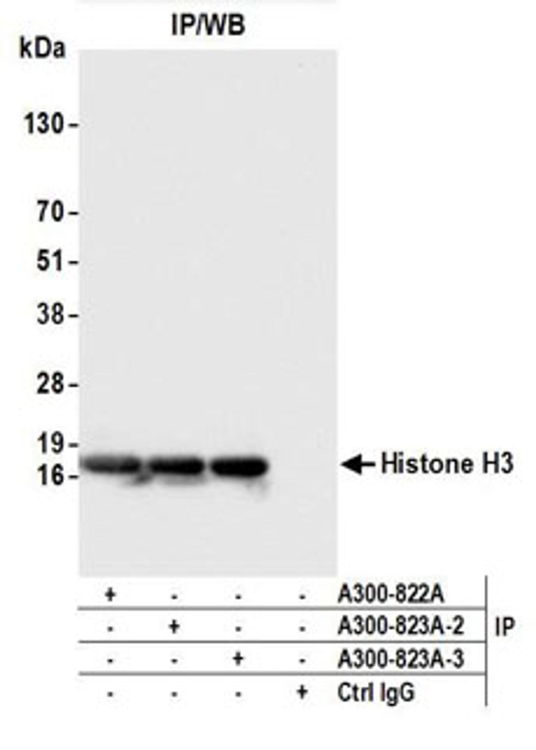 Detection of human Histone H3 by western blot of immunoprecipitates.