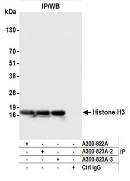 Detection of human Histone H3 by western blot of immunoprecipitates.