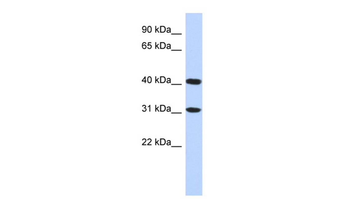 Antibody used in WB on Human HepG2 at 0.2-1 ug/ml.