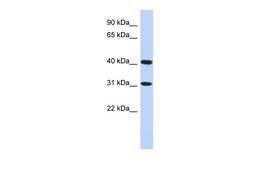 Antibody used in WB on Human HepG2 at 0.2-1 ug/ml.