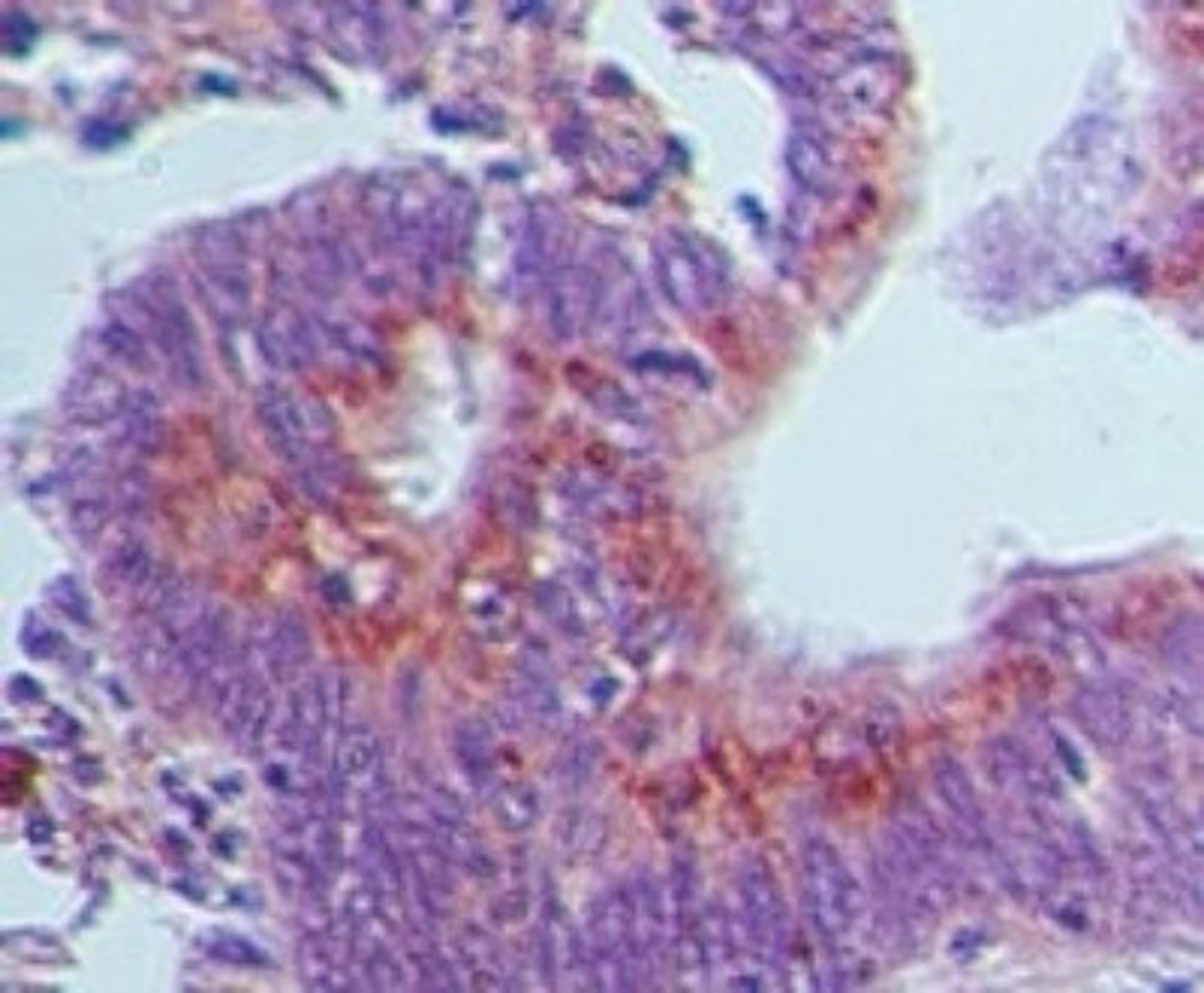 Immunohistochemistry-Paraffin: GBP1 Antibody [NBP2-03972] - Analysis of GBP1 using GBP1 polyclonal antibody. Human rectum tissue probed with GBP1 antibody at 5 ug/ml.