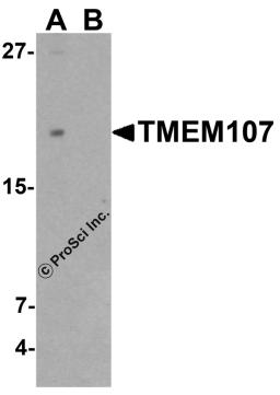Western blot analysis of TMEM107 in THP-1 cell lysate with TMEM107 antibody at 1 μg/ml in (A) the absence and (B) the presence of blocking peptide.