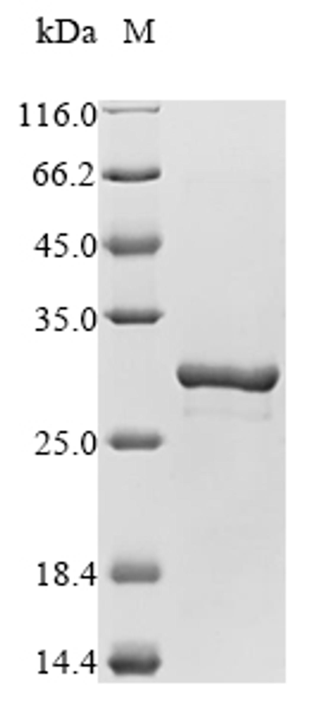 (Tris-Glycine gel) Discontinuous SDS-PAGE (reduced) with 5% enrichment gel and 15% separation gel.