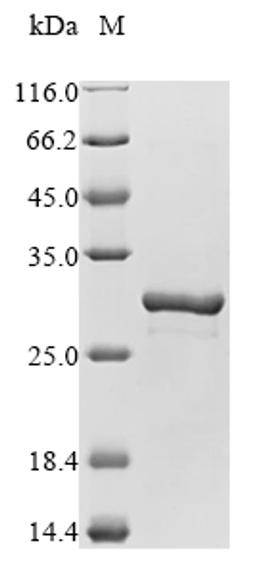 (Tris-Glycine gel) Discontinuous SDS-PAGE (reduced) with 5% enrichment gel and 15% separation gel.