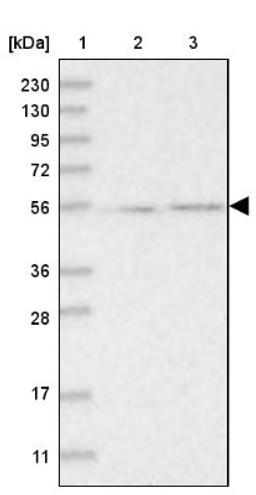 Western Blot: RBM17 Antibody [NBP1-81202] - Lane 1: Marker [kDa] 230, 130, 95, 72, 56, 36, 28, 17, 11<br/>Lane 2: Human cell line RT-4<br/>Lane 3: Human cell line U-251MG sp