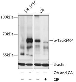 Western blot - Phospho-Tau-S404 antibody (AP0170)