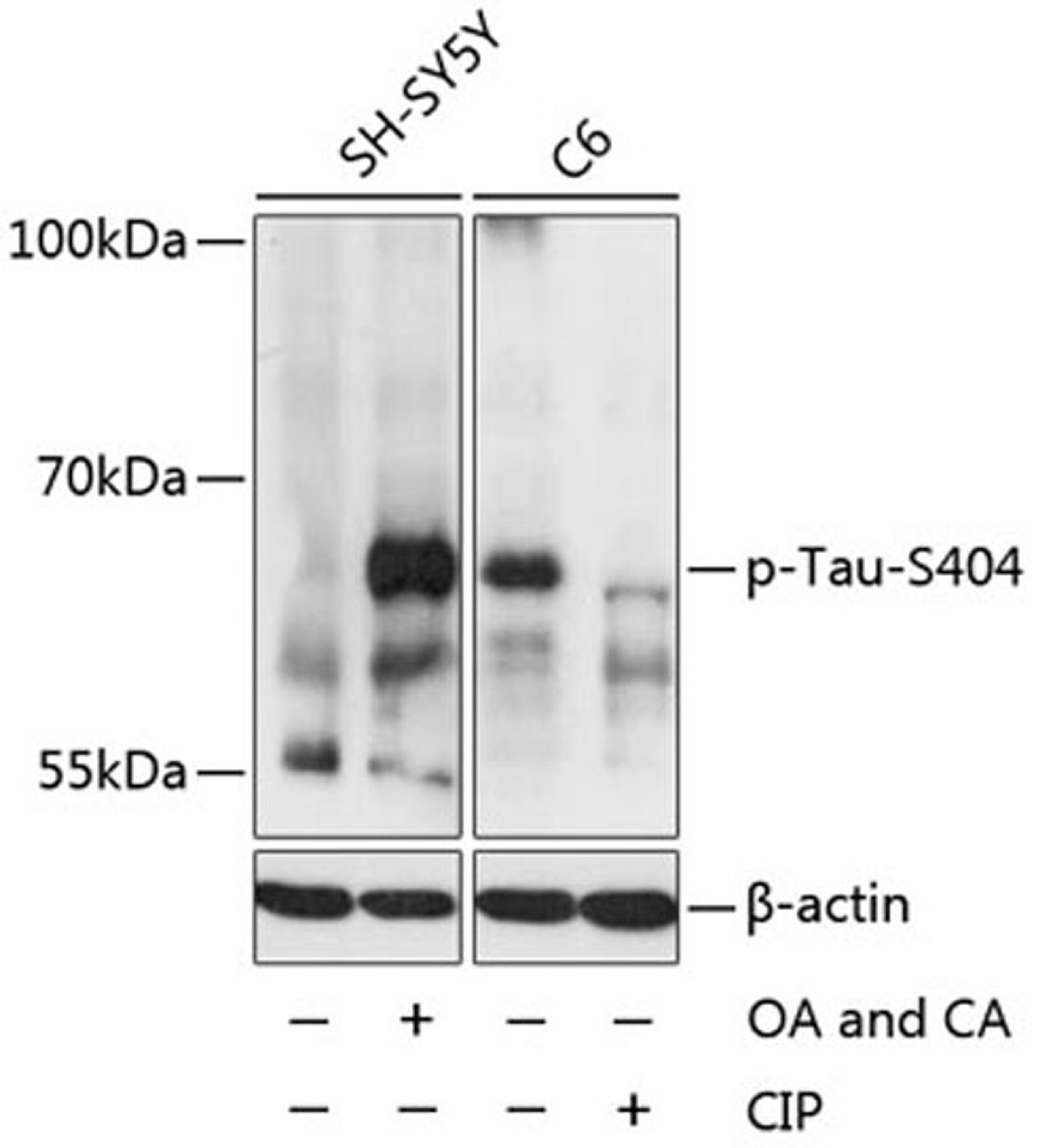 Western blot - Phospho-Tau-S404 antibody (AP0170)