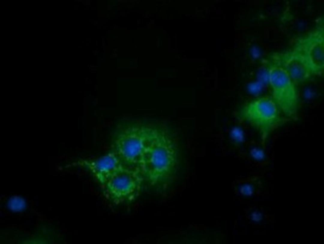 Immunocytochemistry/Immunofluorescence: IVD Antibody (1B10) [NBP2-03047] - Staining of COS7 cells transiently transfected by pCMV6-ENTRY IVD.