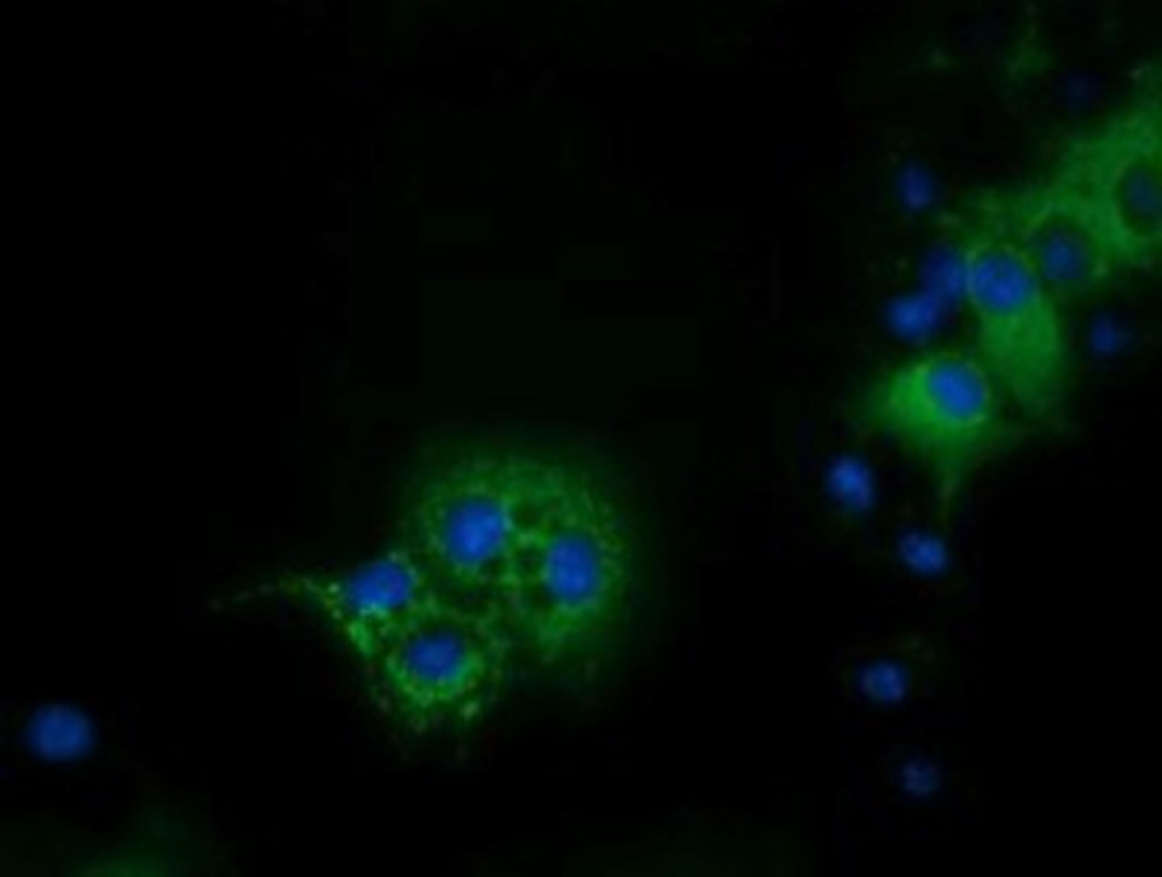 Immunocytochemistry/Immunofluorescence: IVD Antibody (1B10) [NBP2-03047] - Staining of COS7 cells transiently transfected by pCMV6-ENTRY IVD.