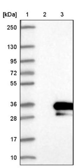 Western Blot: RSG1 Antibody [NBP1-88322] - Lane 1: Marker [kDa] 250, 130, 95, 72, 55, 36, 28, 17, 10<br/>Lane 2: Negative control (vector only transfected HEK293T lysate)<br/>Lane 3: Over-expression lysate (Co-expressed with a C-terminal myc-DDK tag (~3.1 kDa) in mammalian HEK293T cells, LY410666)