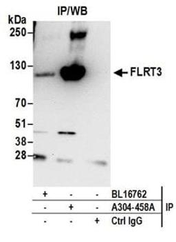 Detection of human FLRT3 by western blot of immunoprecipitates.