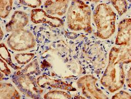 Immunohistochemistry of paraffin-embedded human kidney tissue using CSB-PA004170LA01HU at dilution of 1:100