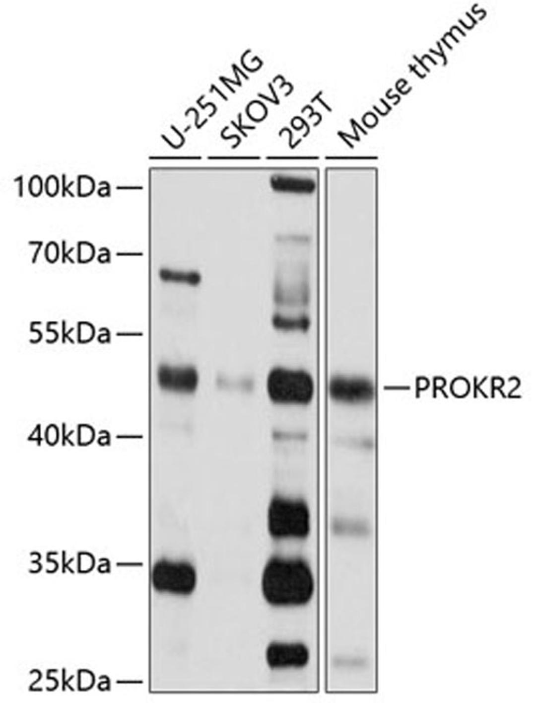 Western blot - PROKR2 antibody (A2960)