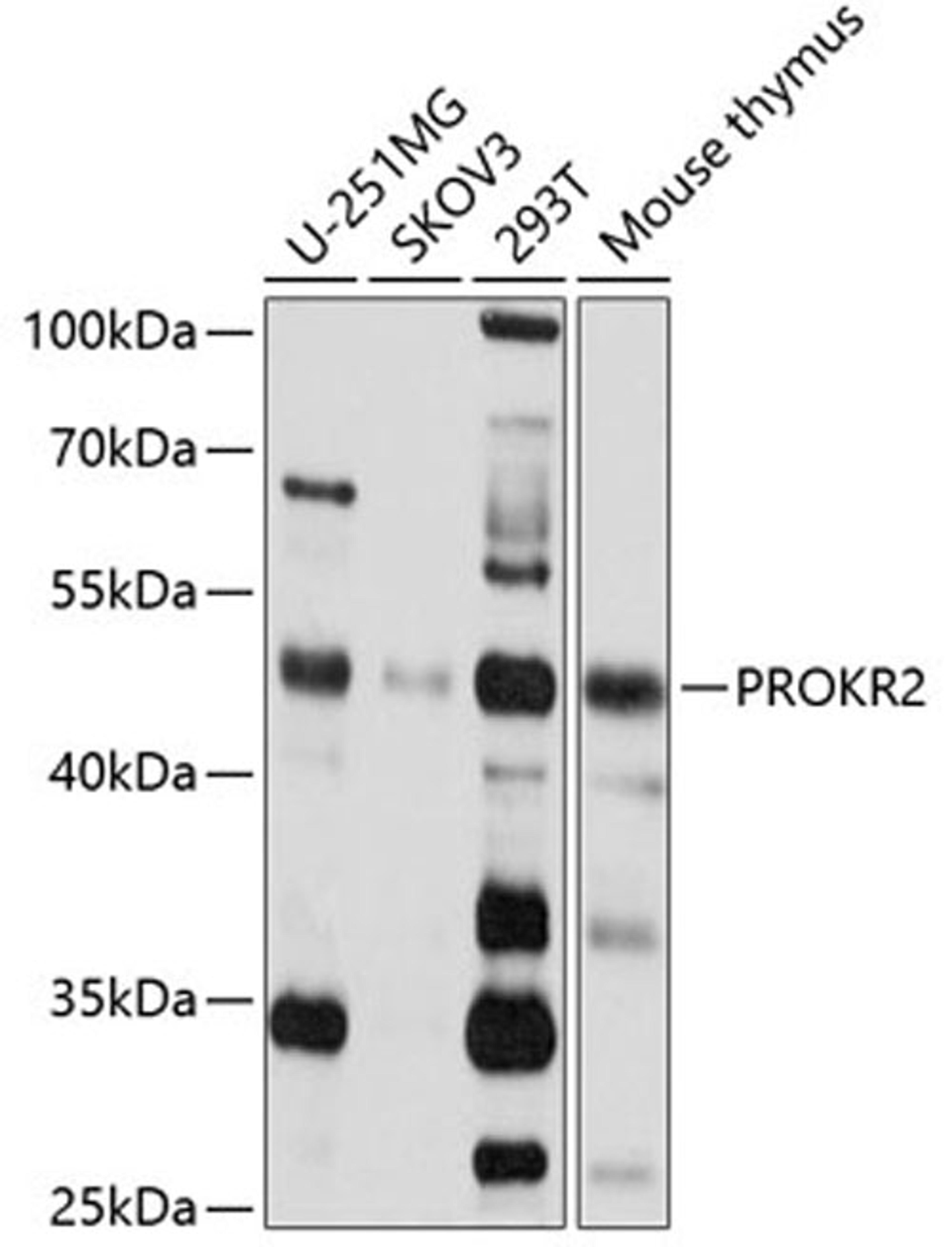 Western blot - PROKR2 antibody (A2960)