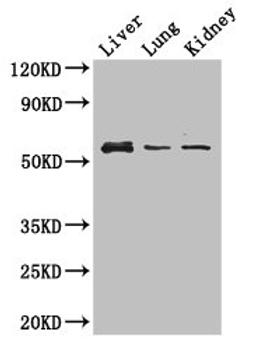 Western Blot. Positive WB detected in: Mouse liver tissue, Mouse lung tissue, Mouse kidney tissue. All lanes: MMP8 antibody at 3ug/ml. Secondary. Goat polyclonal to rabbit IgG at 1/50000 dilution. Predicted band size: 54 kDa. Observed band size: 54 kDa. 