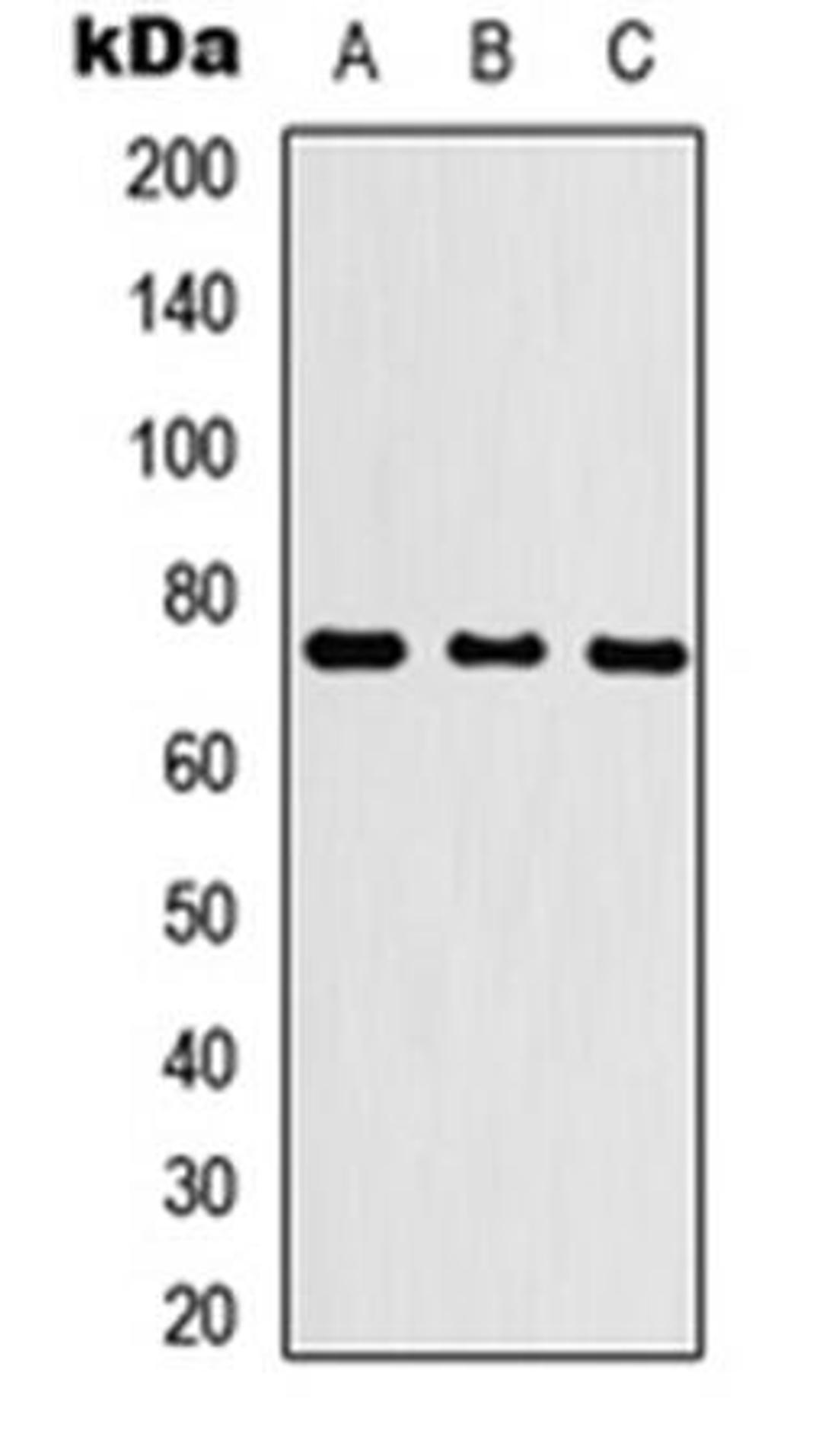 Western blot analysis of HEK293T (Lane1), NS-1 (Lane2), PC12 (Lane3) whole cell using KLHL29 antibody