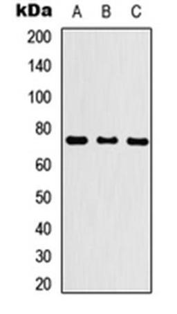 Western blot analysis of HEK293T (Lane1), NS-1 (Lane2), PC12 (Lane3) whole cell using KLHL29 antibody