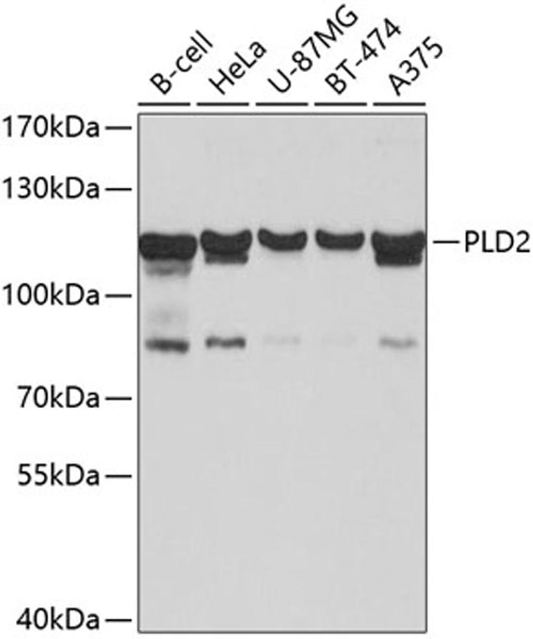 Western blot - PLD2 antibody (A10192)