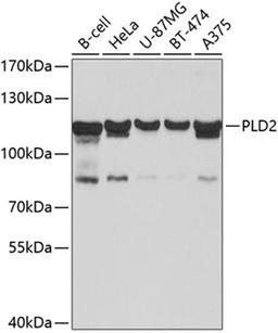 Western blot - PLD2 antibody (A10192)