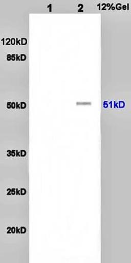 Western blot analysis of rat brain lysates(Lane1),rat heart lysates(Lane2) using Vip Receptor I antibody