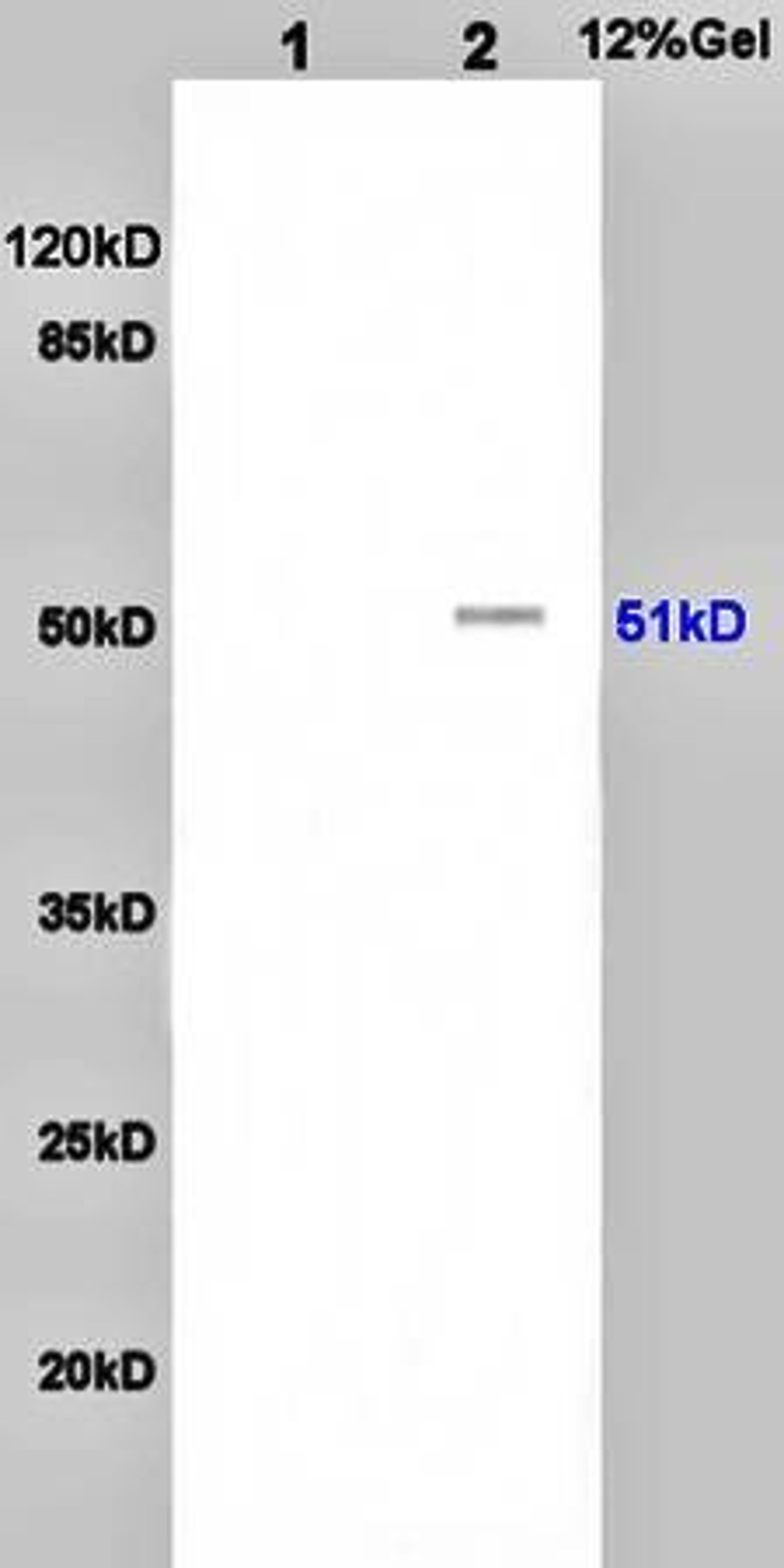 Western blot analysis of rat brain lysates(Lane1),rat heart lysates(Lane2) using Vip Receptor I antibody