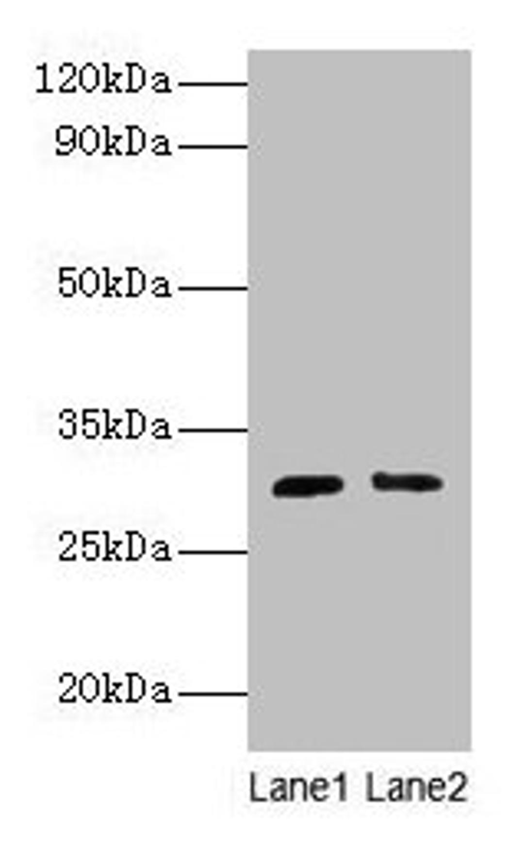 Western blot. All lanes: Cd82 antibody at 2µg/ml. Lane 1: Jurkat whole cell lysate. Lane 2: A549 whole cell lysate. Secondary. Goat polyclonal to rabbit IgG at 1/10000 dilution. Predicted band size: 30 kDa. Observed band size: 30 kDa