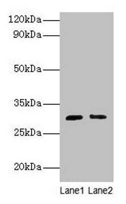 Western blot. All lanes: Cd82 antibody at 2µg/ml. Lane 1: Jurkat whole cell lysate. Lane 2: A549 whole cell lysate. Secondary. Goat polyclonal to rabbit IgG at 1/10000 dilution. Predicted band size: 30 kDa. Observed band size: 30 kDa