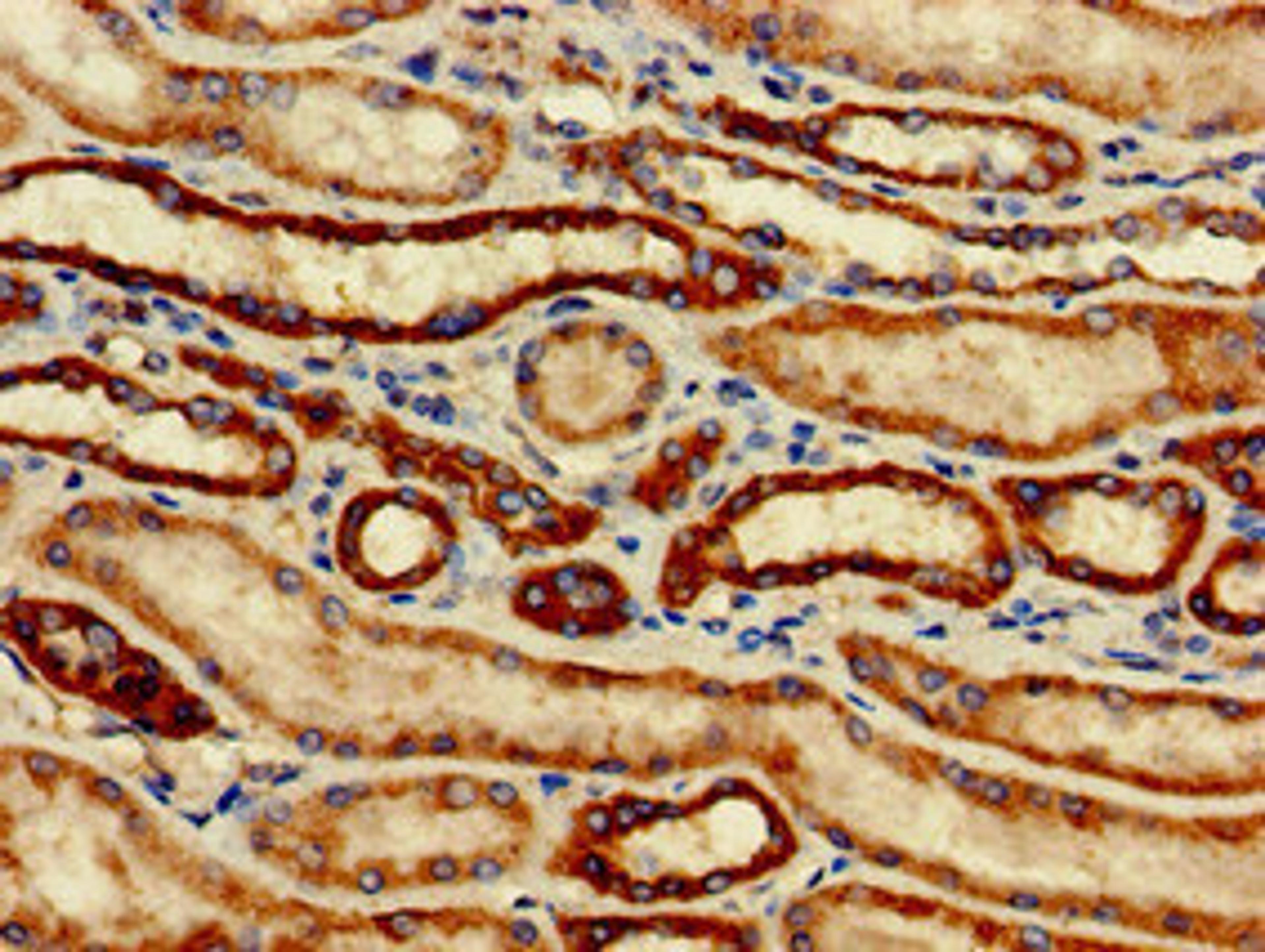 Immunohistochemistry of paraffin-embedded human kidney tissue using CSB-PA896546LA01HU at dilution of 1:100