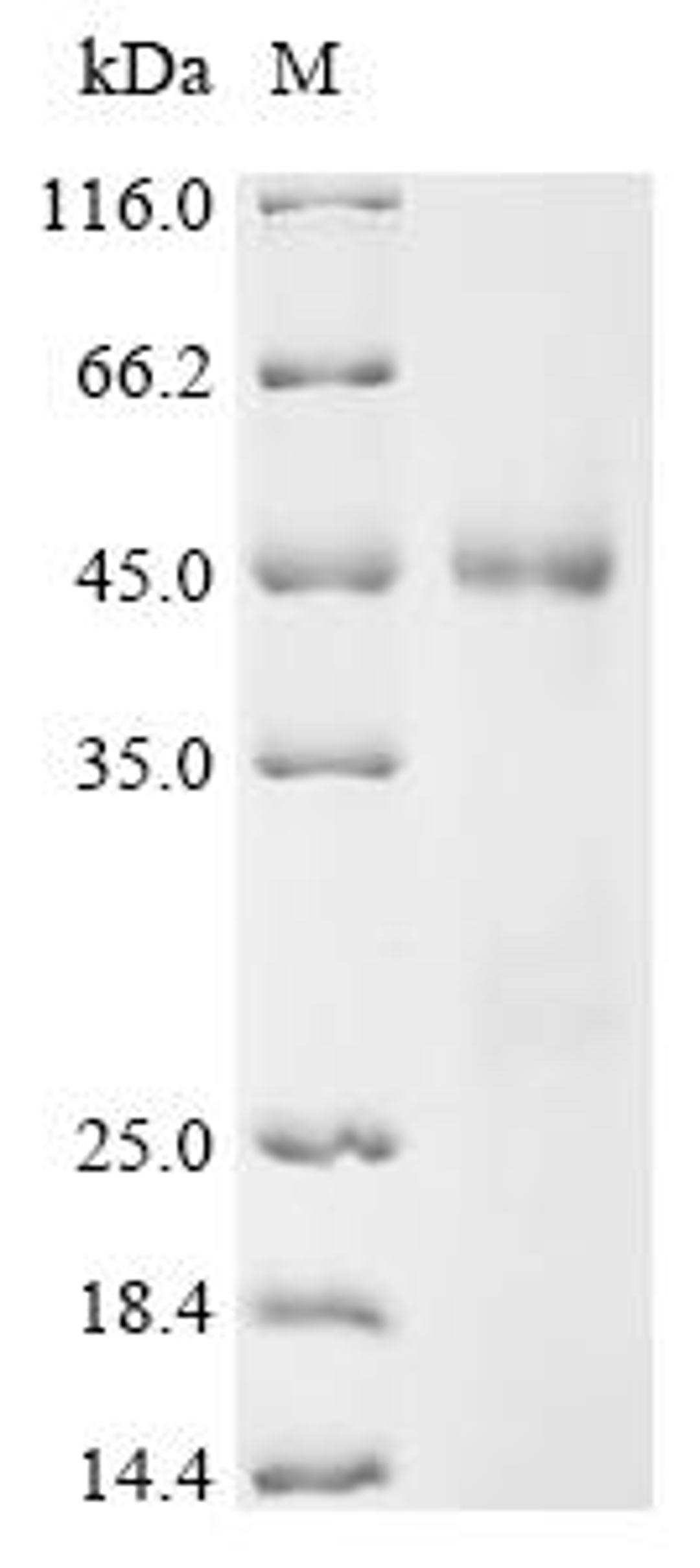 (Tris-Glycine gel) Discontinuous SDS-PAGE (reduced) with 5% enrichment gel and 15% separation gel.