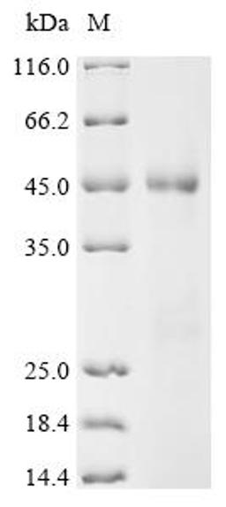(Tris-Glycine gel) Discontinuous SDS-PAGE (reduced) with 5% enrichment gel and 15% separation gel.
