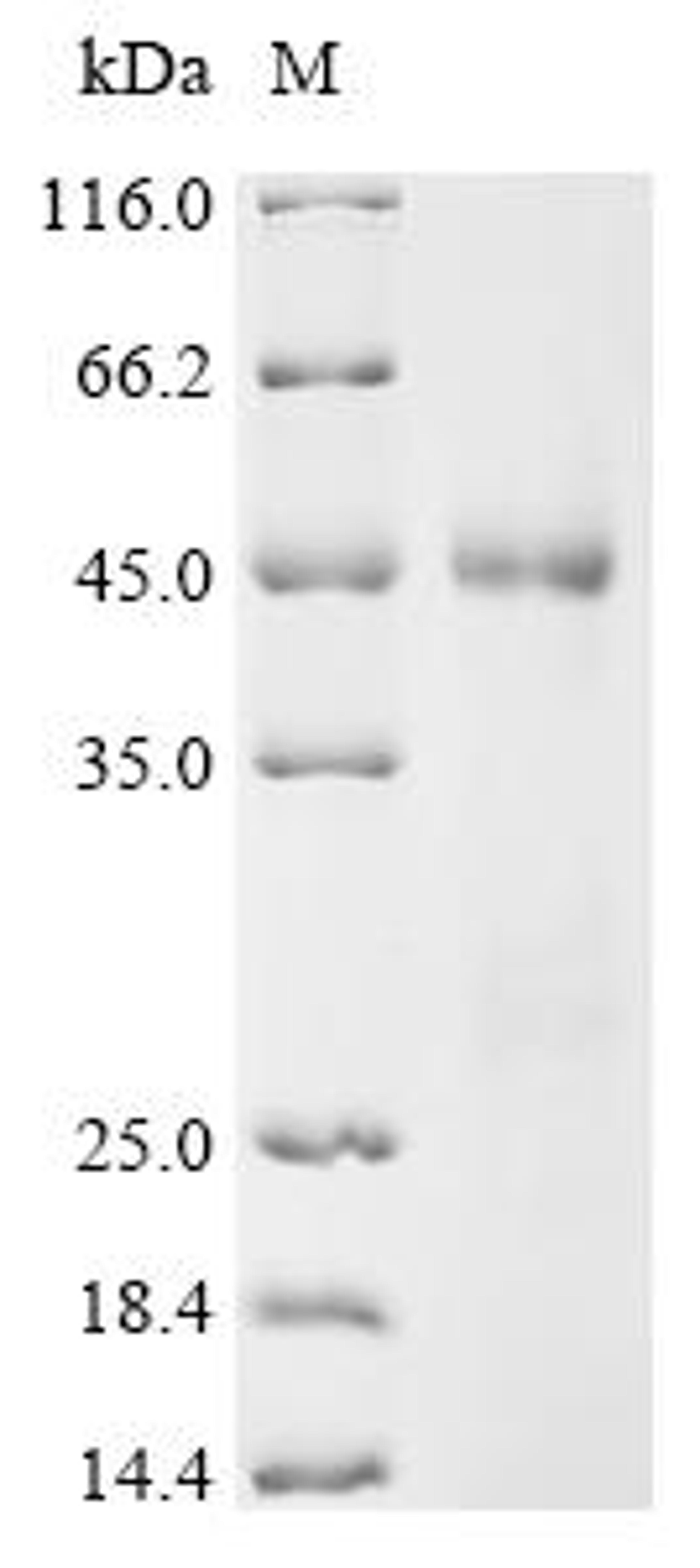 (Tris-Glycine gel) Discontinuous SDS-PAGE (reduced) with 5% enrichment gel and 15% separation gel.