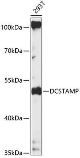 Western blot - DCSTAMP antibody (A14630)