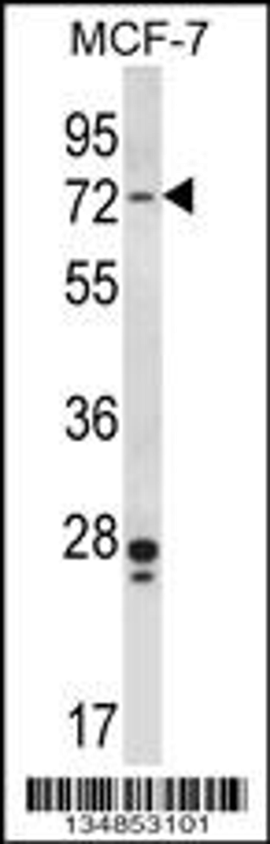 Western blot analysis in MCF-7 cell line lysates (35ug/lane).