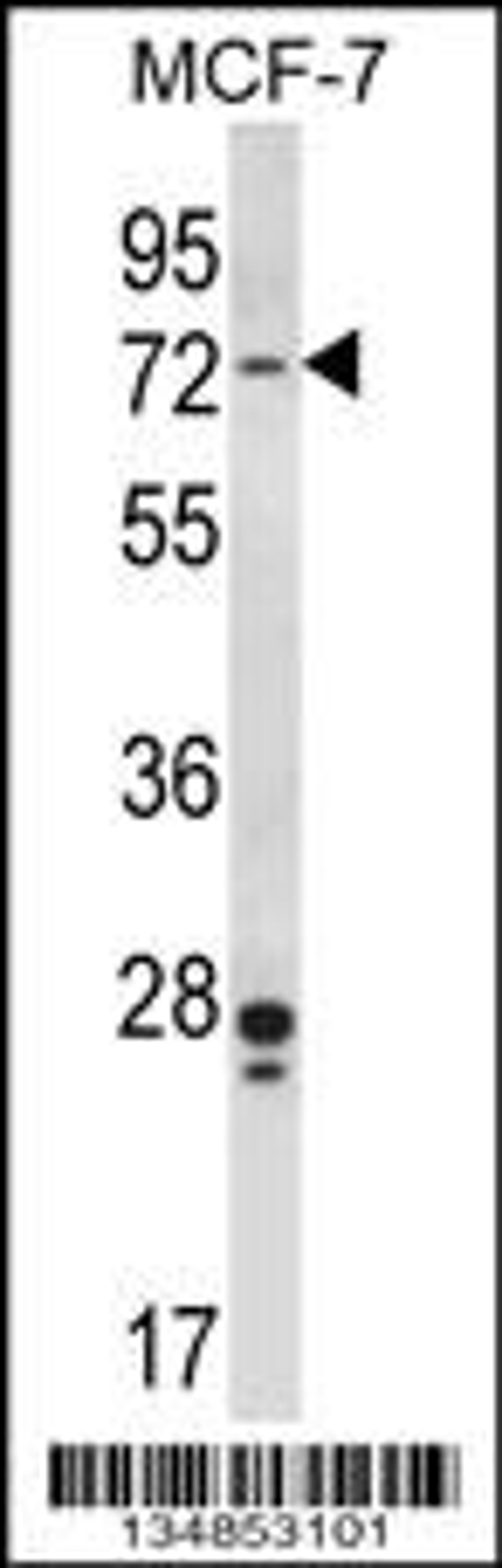 Western blot analysis in MCF-7 cell line lysates (35ug/lane).