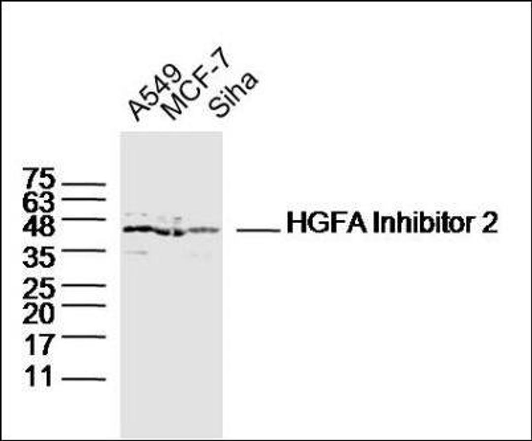 Western blot analysis of A549 Cell Human Lysate , MCF-7 cell Human Lysate,Siha Cell Human Lysate using HGFA Inhibitor 2 antibody.