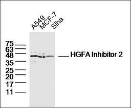 Western blot analysis of A549 Cell Human Lysate , MCF-7 cell Human Lysate,Siha Cell Human Lysate using HGFA Inhibitor 2 antibody.