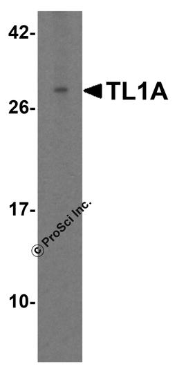 Western blot analysis of TL1A in human placenta tissue lysate with TL1A antibody at 2 μg/mL.