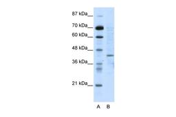 Antibody used in WB on Human HepG2 at 5.0 ug/ml.