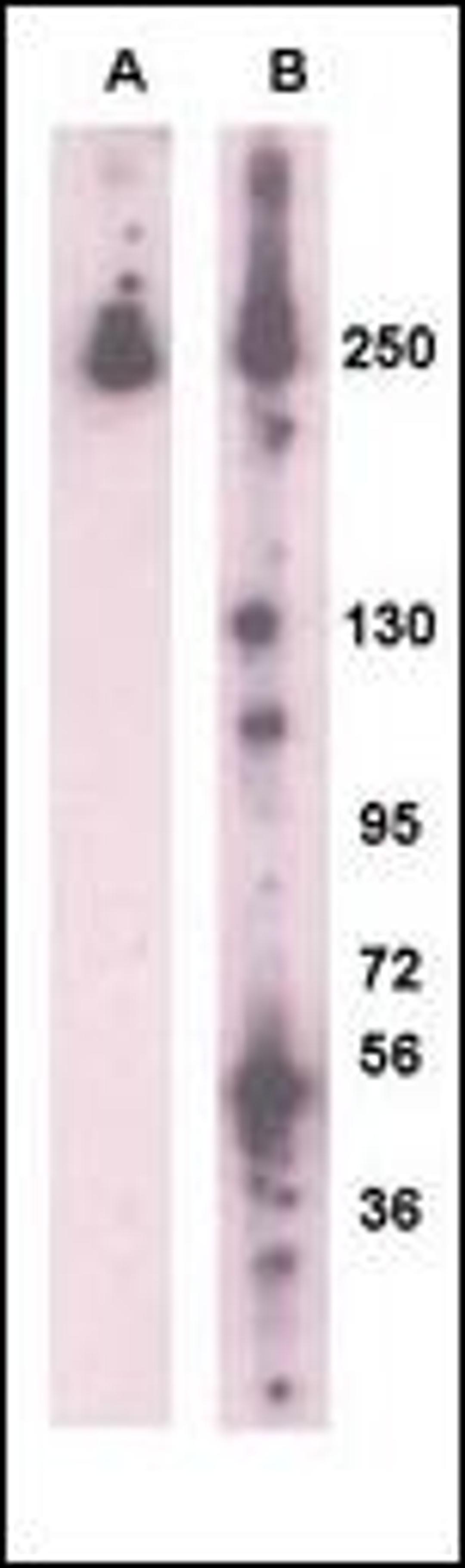 Western blot analysis of PARK8 (LRRK2) using rabbit polyclonal PARK8 (LRRK2)Antibody (L899). (A) 293 cell lysate (2 ug) transiently transfected with the PARK8 gene. (B) Mouse brain lysates (35ug/lane). PARK8 was detected using the purified polyclonal anti