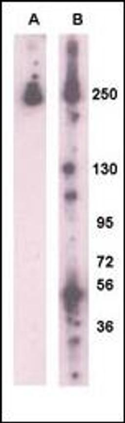 Western blot analysis of PARK8 (LRRK2) using rabbit polyclonal PARK8 (LRRK2)Antibody (L899). (A) 293 cell lysate (2 ug) transiently transfected with the PARK8 gene. (B) Mouse brain lysates (35ug/lane). PARK8 was detected using the purified polyclonal anti