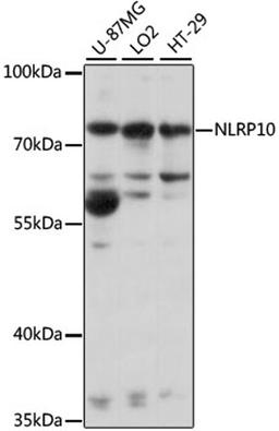 Western blot - NLRP10 antibody (A15976)