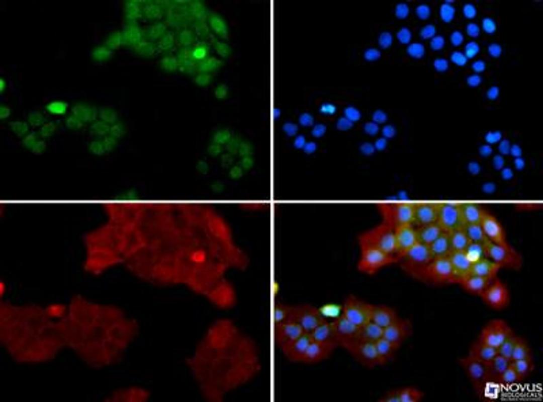 Immunocytochemistry/Immunofluorescence: SUV420h1 Antibody [NBP1-97313] - SUV420h1 antibody was tested in A431 cells with FITC (green). Nuclei and alpha-tubulin were counterstained with DAPI (blue) and Dylight 550 (red).