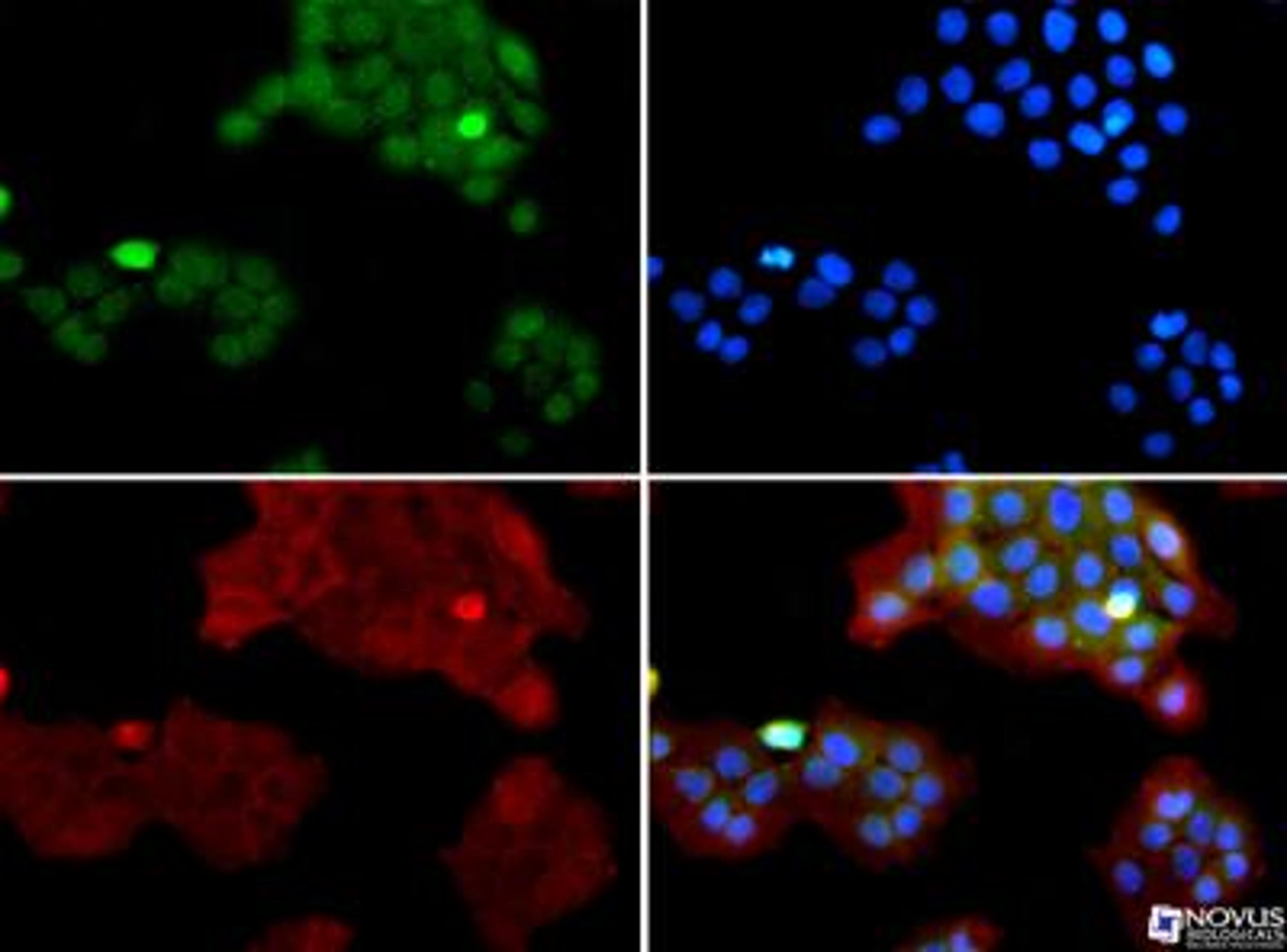 Immunocytochemistry/Immunofluorescence: SUV420h1 Antibody [NBP1-97313] - SUV420h1 antibody was tested in A431 cells with FITC (green). Nuclei and alpha-tubulin were counterstained with DAPI (blue) and Dylight 550 (red).