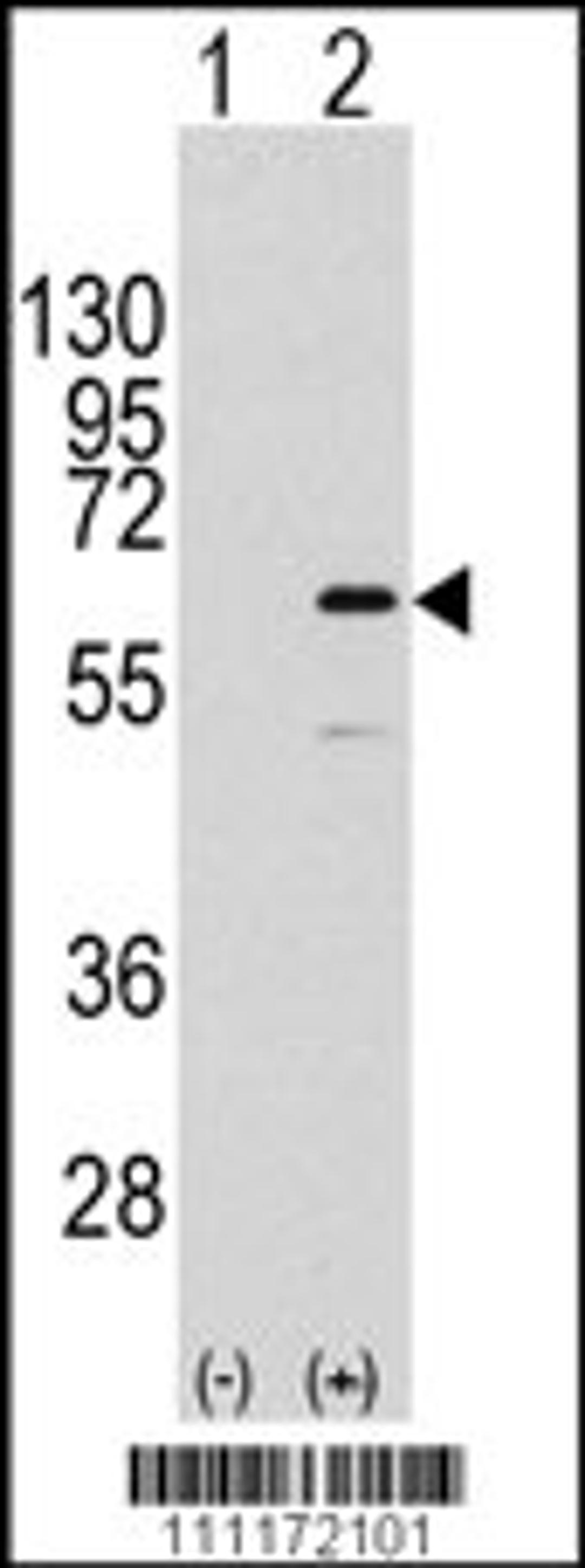 Western blot analysis of ELK1 using rabbit polyclonal ELK1 Antibody (S383) using 293 cell lysates (2 ug/lane) either nontransfected (Lane 1) or transiently transfected with the ELK1 gene (Lane 2).