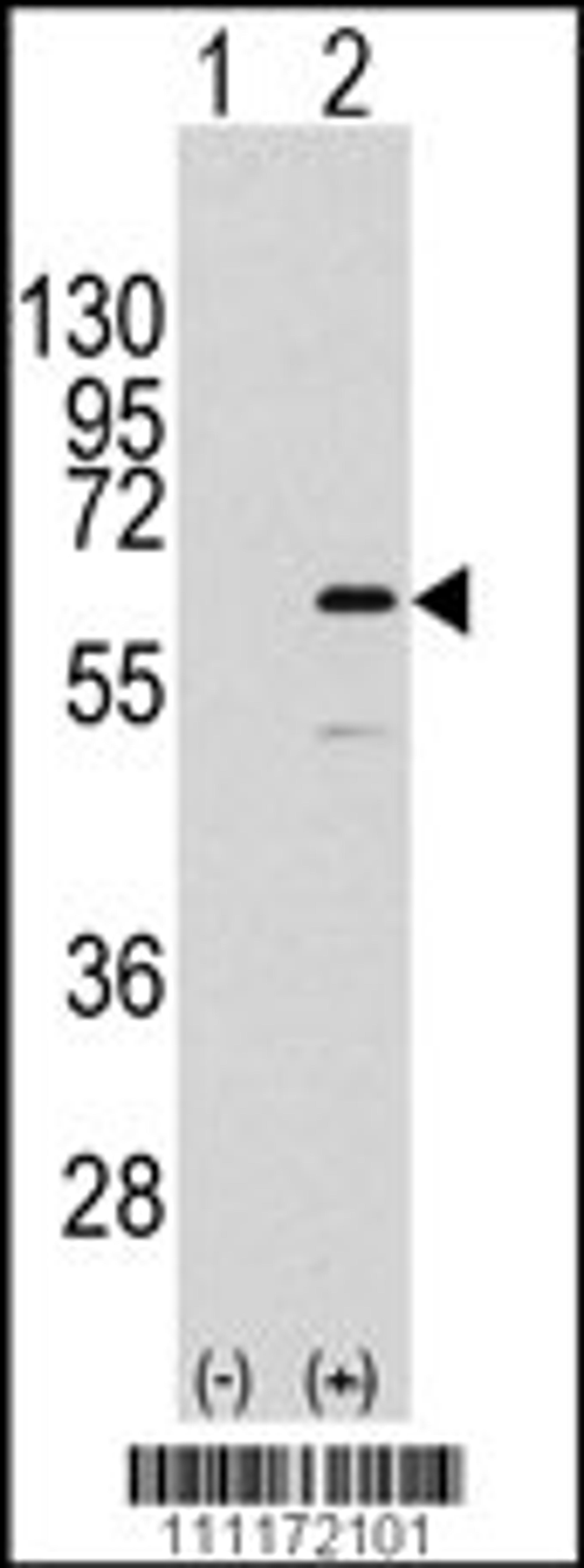 Western blot analysis of ELK1 using rabbit polyclonal ELK1 Antibody (S383) using 293 cell lysates (2 ug/lane) either nontransfected (Lane 1) or transiently transfected with the ELK1 gene (Lane 2).