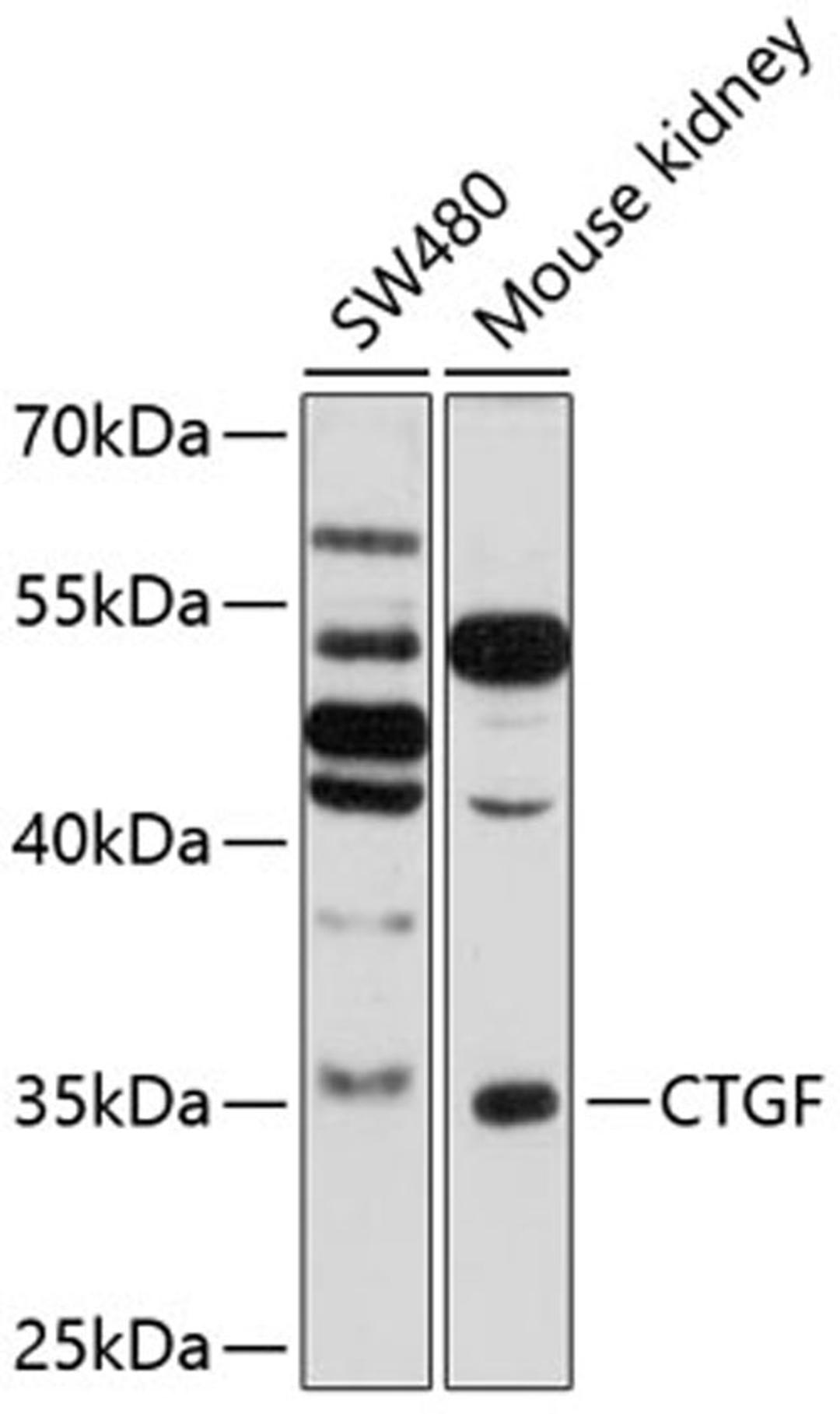 Western blot - CTGF antibody (A11456)