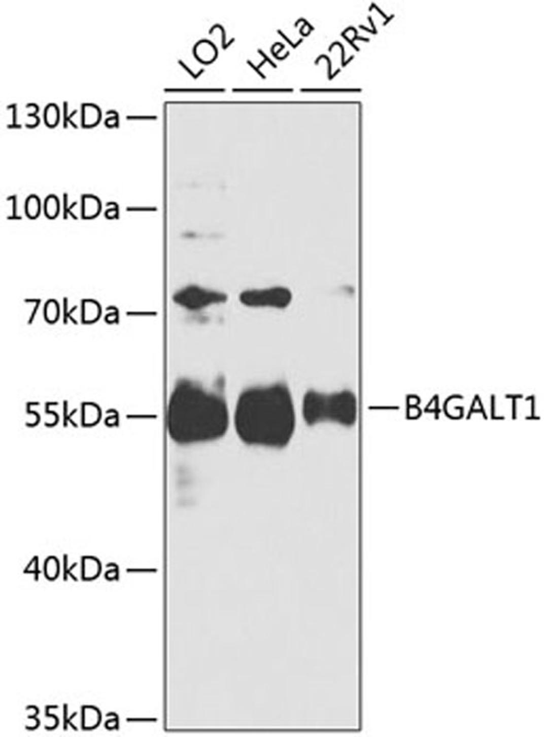 Western blot - B4GALT1 antibody (A8546)